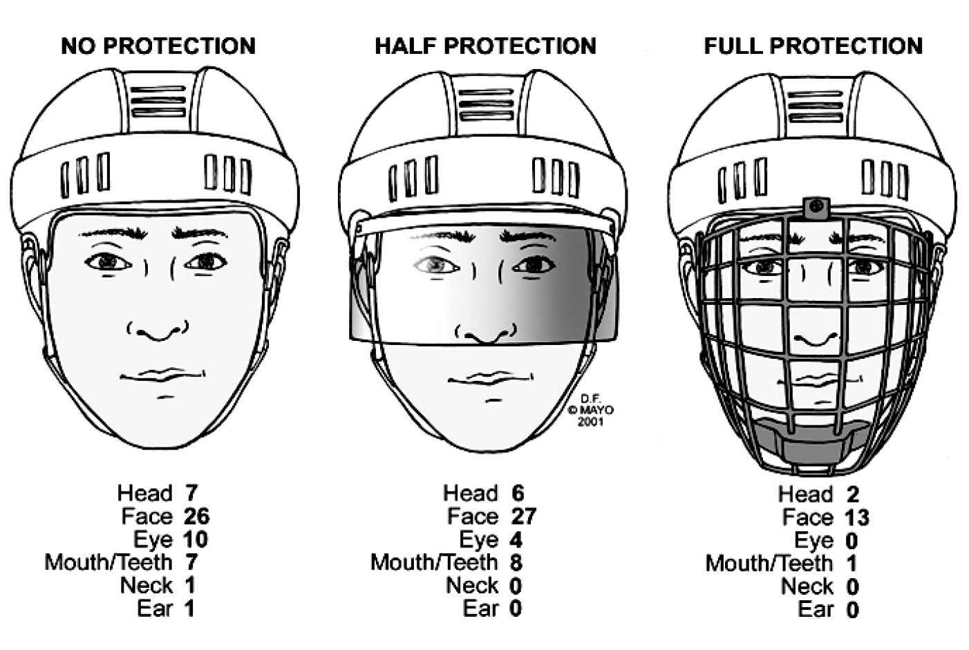 Preventing Ice Hockey Injuries